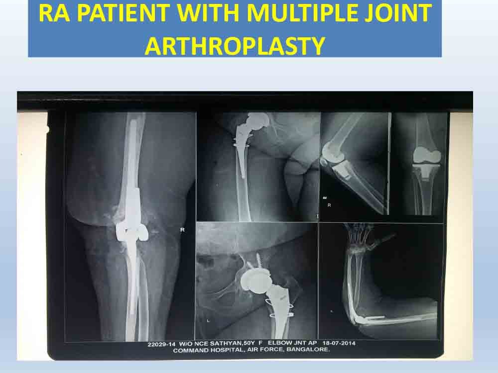 PowerPoint Presentation