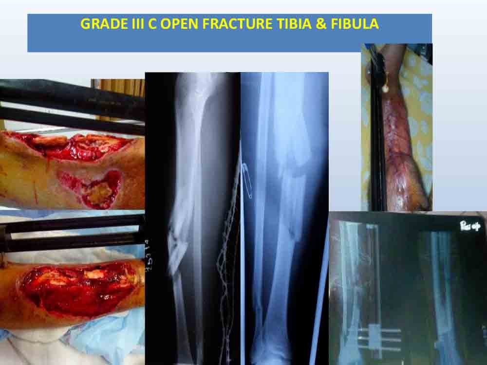 PowerPoint Presentation