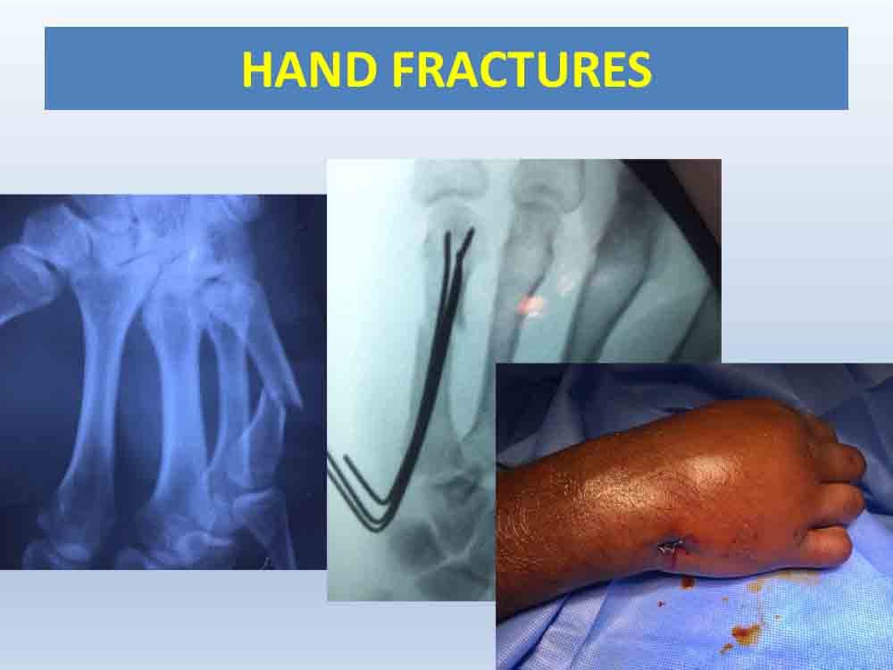 PowerPoint Presentation