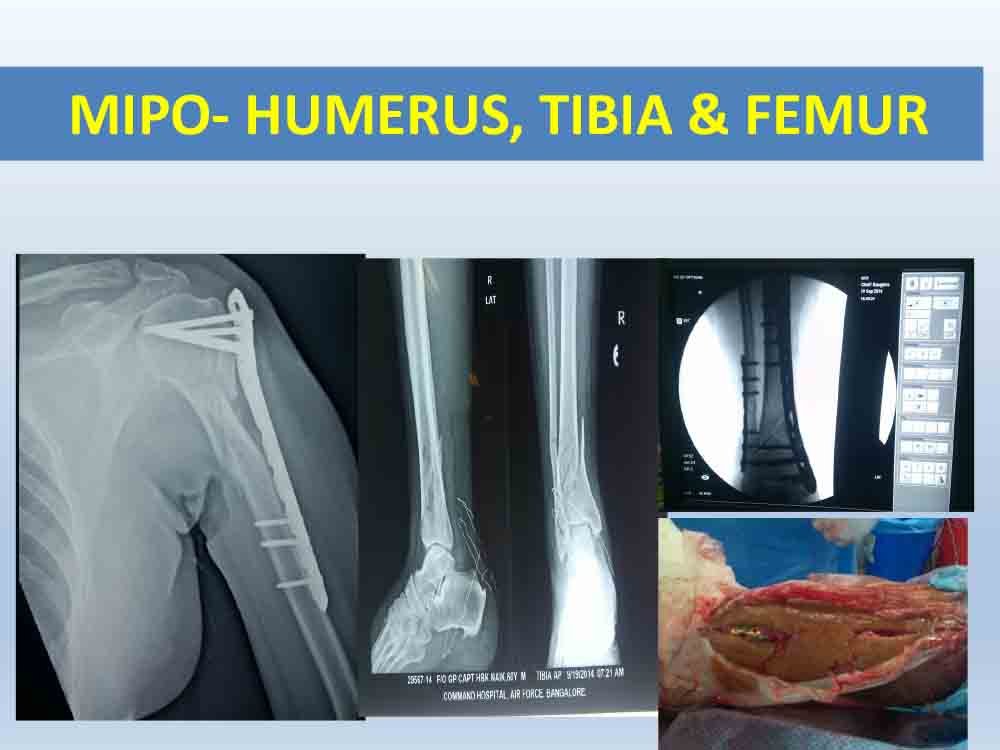 PowerPoint Presentation