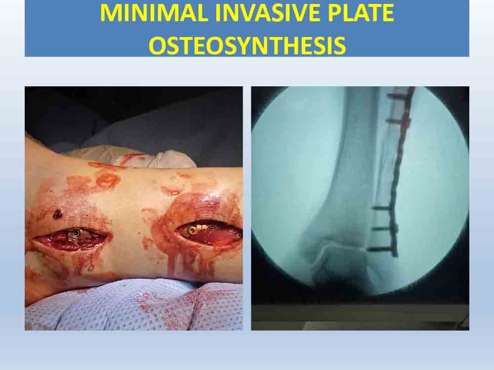 PowerPoint Presentation