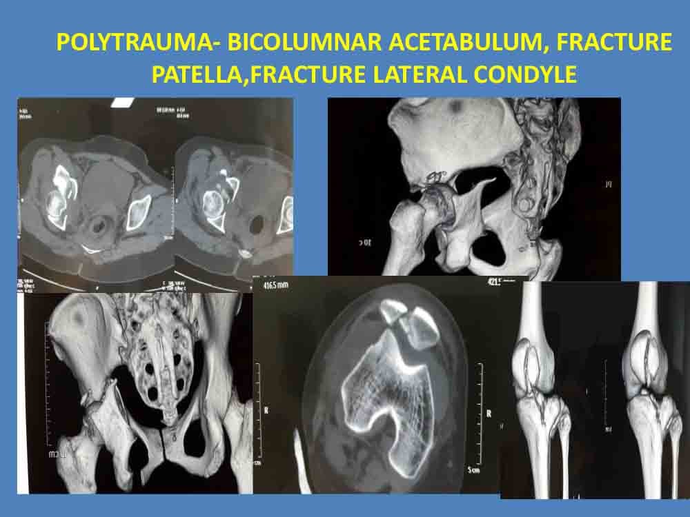 PowerPoint Presentation