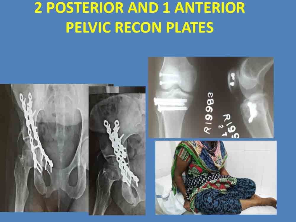 PowerPoint Presentation