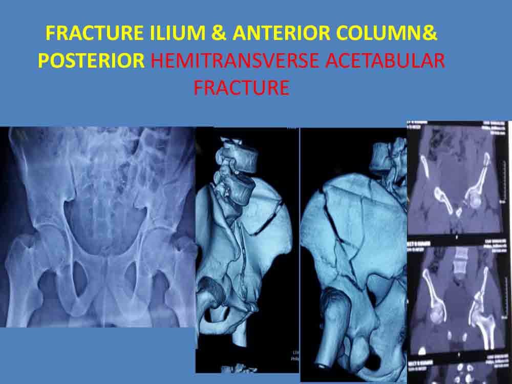 PowerPoint Presentation