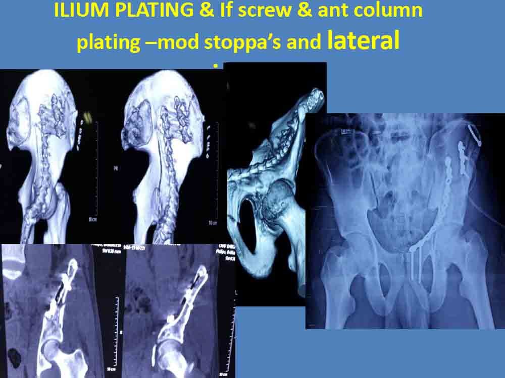 PowerPoint Presentation