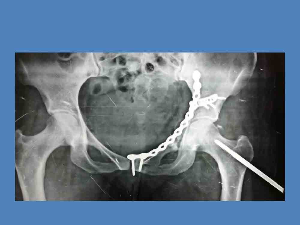 PowerPoint Presentation