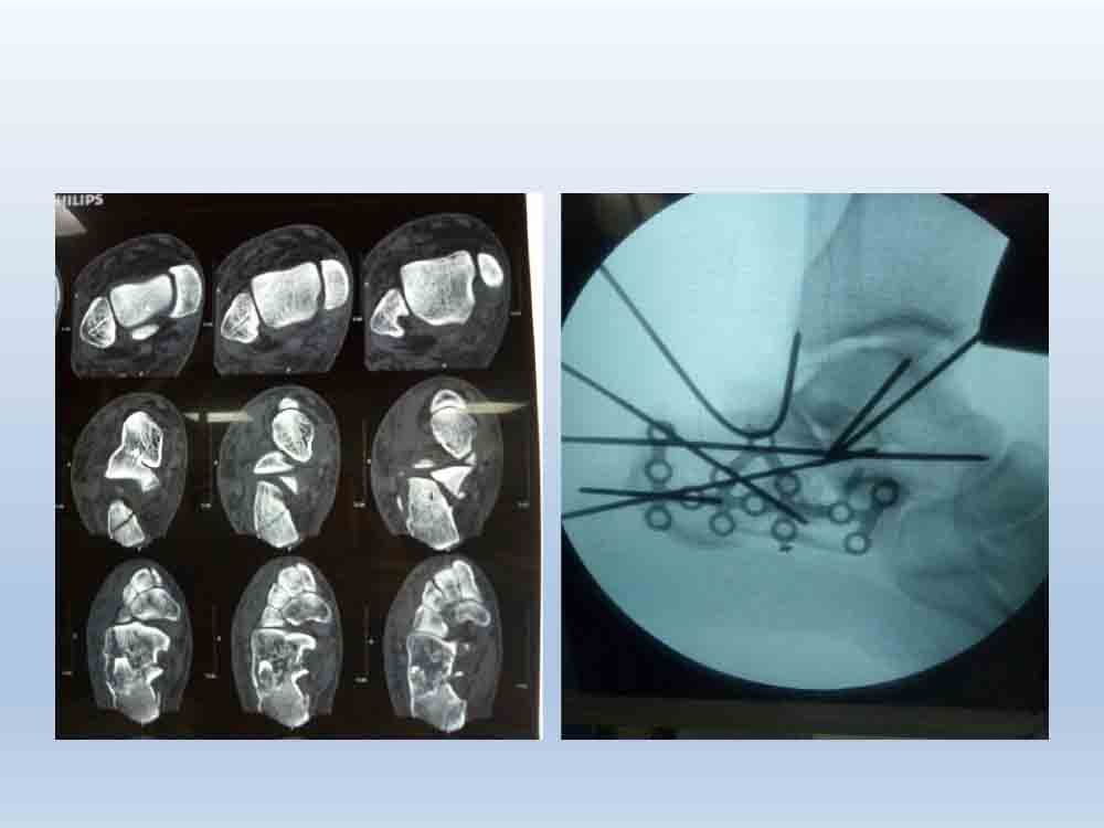 PowerPoint Presentation