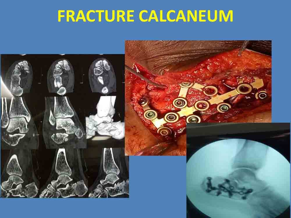 PowerPoint Presentation