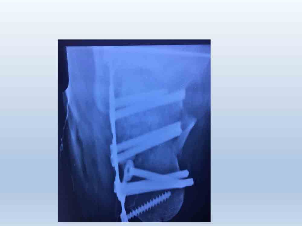 PowerPoint Presentation