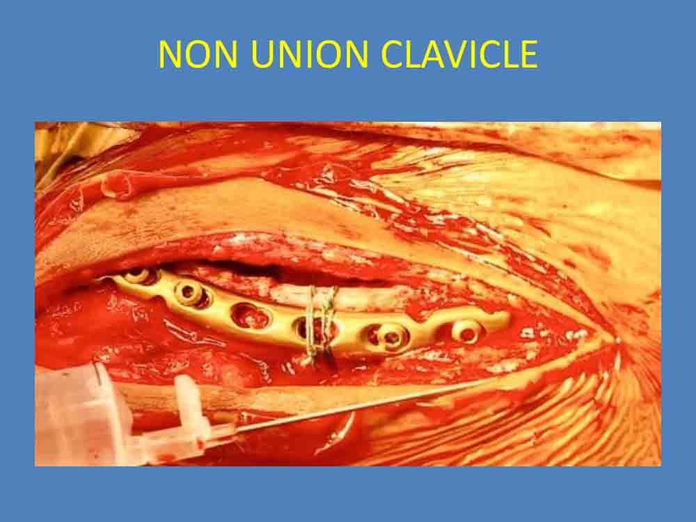 PowerPoint Presentation