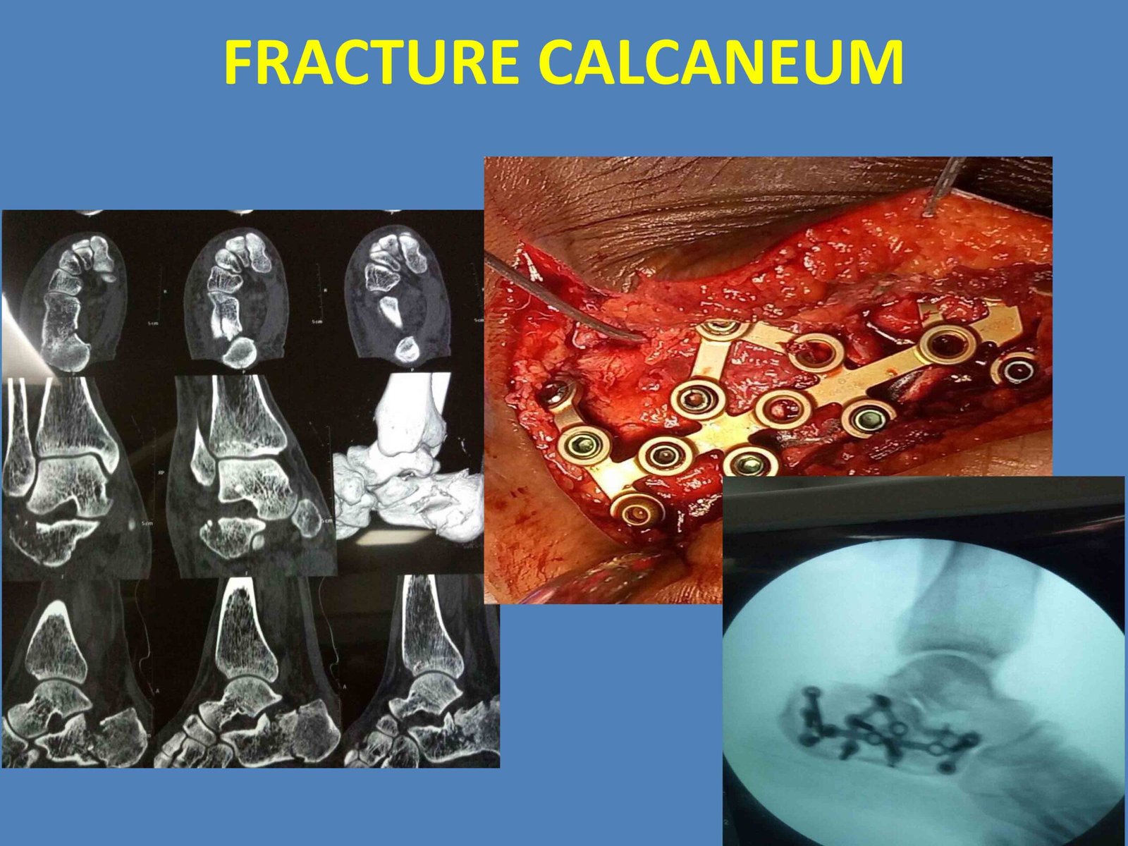 PowerPoint Presentation